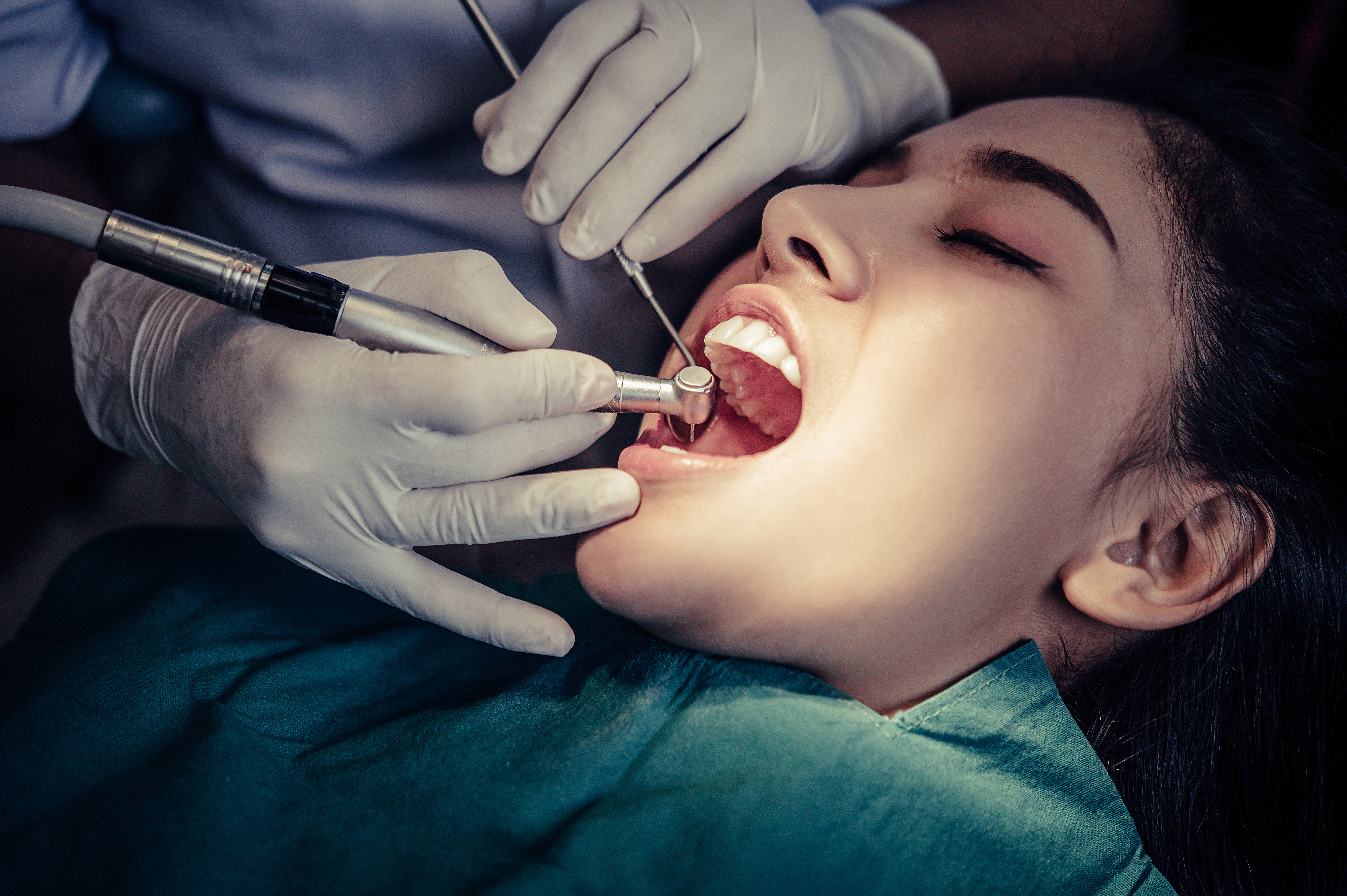 Teeth Extractions in pune